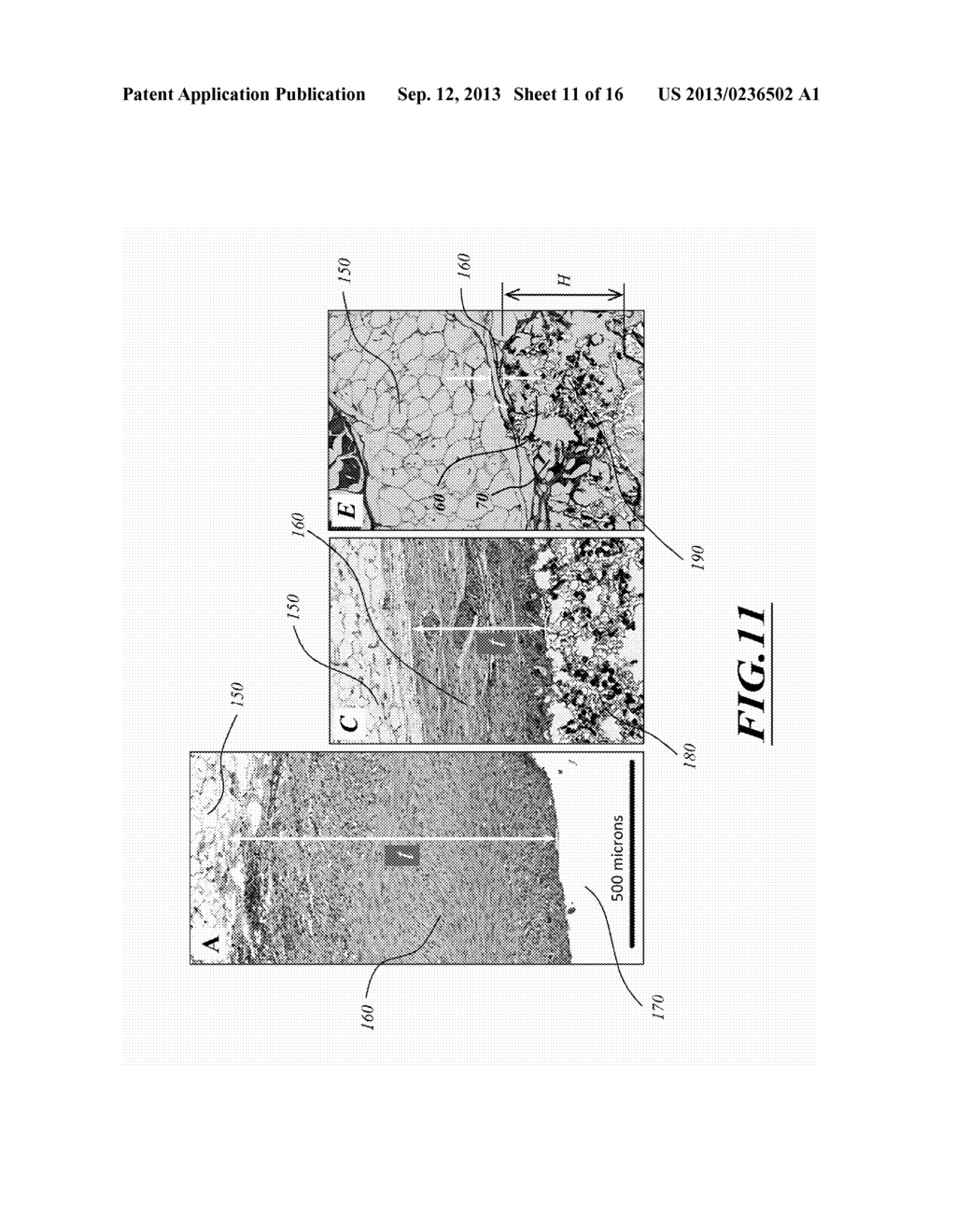 IMPLANTABLE MEDICAL DEVICES HAVING MICROPOROUS SURFACE LAYERS AND METHOD     FOR REDUCING FOREIGN BODY RESPONSE TO THE SAME - diagram, schematic, and image 12