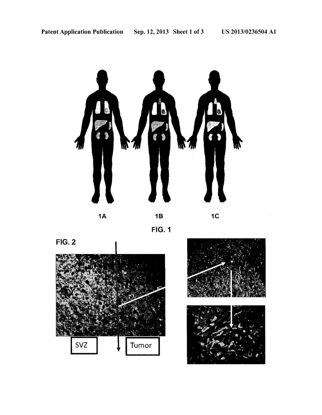 Delivery System for Enhancing Drug Efficacy - diagram, schematic, and image 02