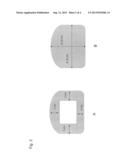 AMNION AND CHORION CONSTRUCTS AND USES THEREOF IN OB-GYN SURGERY diagram and image