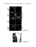 Vaccine Nanotechnology diagram and image