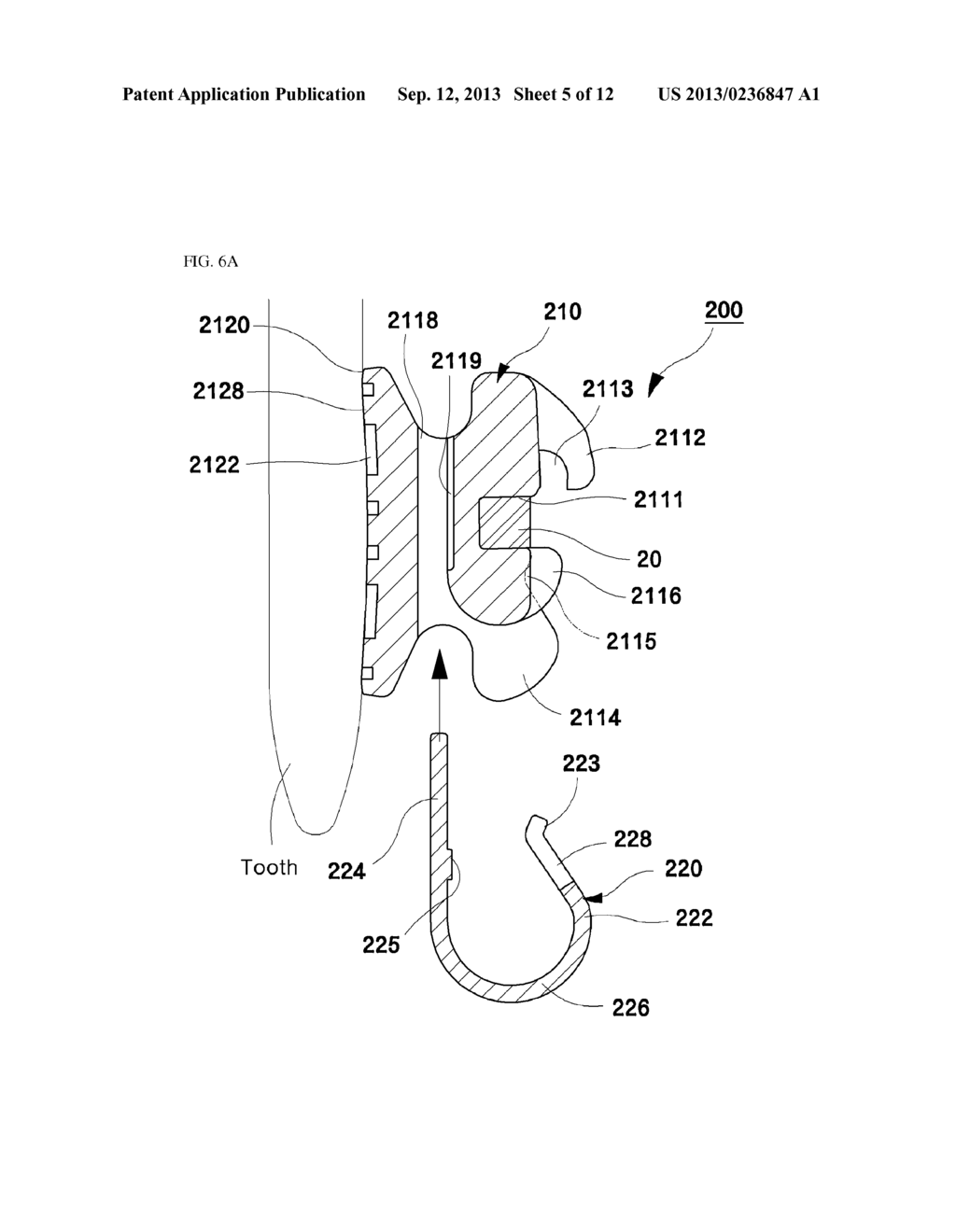 SELF-LIGATION ORTHODONTIC BRACKET - diagram, schematic, and image 06