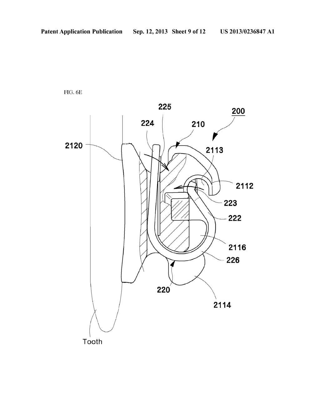 SELF-LIGATION ORTHODONTIC BRACKET - diagram, schematic, and image 10