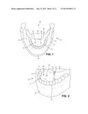 Sialendoscopy Demonstration Apparatus diagram and image