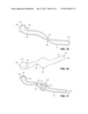 Sialendoscopy Demonstration Apparatus diagram and image