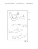 Sialendoscopy Demonstration Apparatus diagram and image