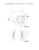 Sialendoscopy Demonstration Apparatus diagram and image