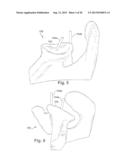 METHOD AND SYSTEM FOR PRODUCING AT LEAST ONE PATIENT-SPECIFIC SURGICAL AID diagram and image