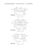 METHOD AND SYSTEM FOR PRODUCING AT LEAST ONE PATIENT-SPECIFIC SURGICAL AID diagram and image