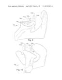 METHOD AND SYSTEM FOR PRODUCING AT LEAST ONE PATIENT-SPECIFIC SURGICAL AID diagram and image