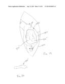 METHOD AND SYSTEM FOR PRODUCING AT LEAST ONE PATIENT-SPECIFIC SURGICAL AID diagram and image