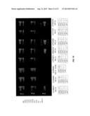 DRUG SELECTION FOR GASTRIC CANCER THERAPY USING ANTIBODY-BASED ARRAYS diagram and image