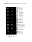 DRUG SELECTION FOR GASTRIC CANCER THERAPY USING ANTIBODY-BASED ARRAYS diagram and image