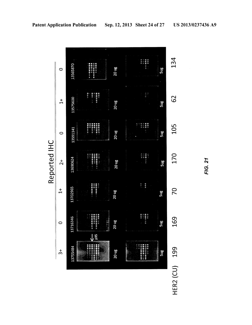 DRUG SELECTION FOR GASTRIC CANCER THERAPY USING ANTIBODY-BASED ARRAYS - diagram, schematic, and image 25