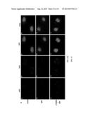 BERBERINE ALKALOID AS A MEDICAMENT FOR PREVENTION AND TREATMENT OF NEURAL     DISEASE diagram and image