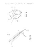 DEVICES AND METHODS FOR ASSISTING CARDIAC FUNCTION diagram and image