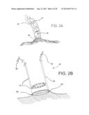 DEVICES AND METHODS FOR ASSISTING CARDIAC FUNCTION diagram and image