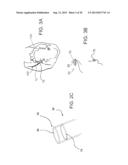 DEVICES AND METHODS FOR ASSISTING CARDIAC FUNCTION diagram and image