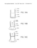 DEVICES AND METHODS FOR ASSISTING CARDIAC FUNCTION diagram and image