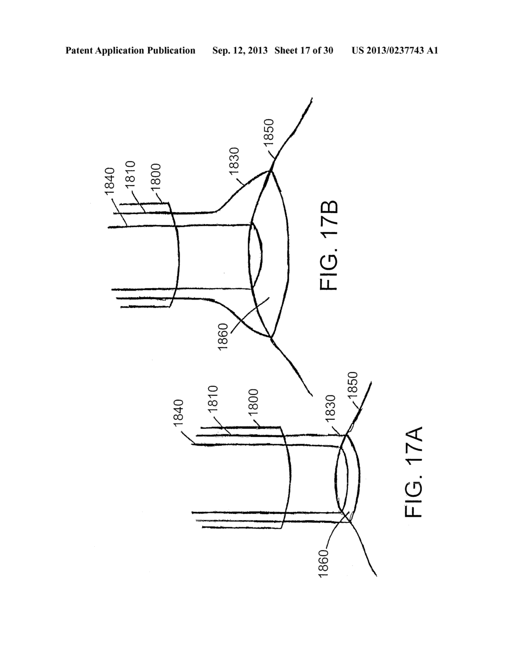 DEVICES AND METHODS FOR ASSISTING CARDIAC FUNCTION - diagram, schematic, and image 18