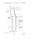 Otoscanning With 3D Modeling diagram and image