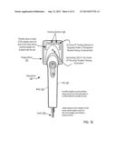 Otoscanning With 3D Modeling diagram and image