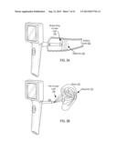 Otoscanning With 3D Modeling diagram and image