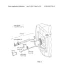 Otoscanning With 3D Modeling diagram and image