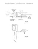 Otoscanning With 3D Modeling diagram and image