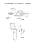 Otoscanning With 3D Modeling diagram and image