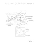 Otoscanning With 3D Modeling diagram and image