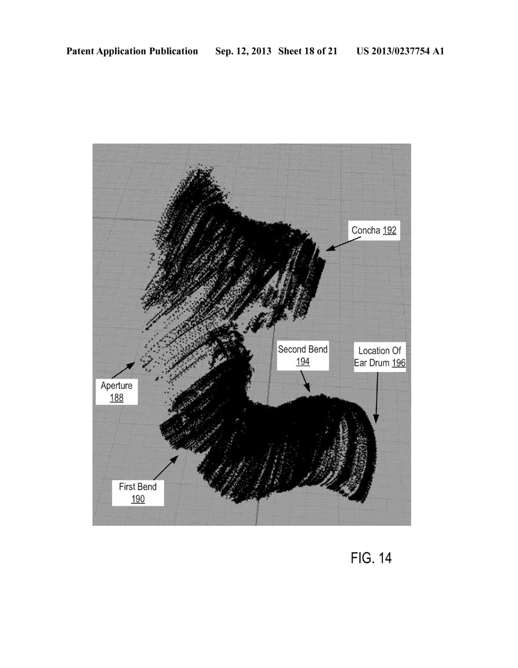 Otoscanning With 3D Modeling - diagram, schematic, and image 19