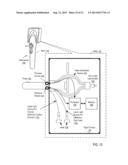 Otoscanning With 3D Modeling diagram and image