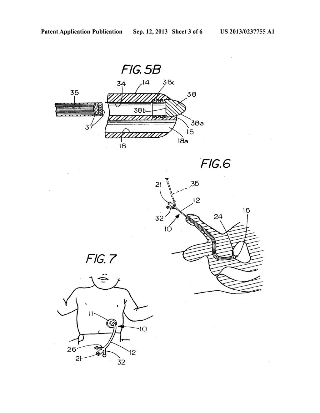 FLEXIBLE VISUALLY DIRECTED MEDICAL INTUBATION INSTRUMENT AND METHOD - diagram, schematic, and image 04