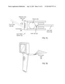 Otoscanner with Camera For Video And Scanning diagram and image