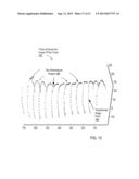 Otoscanner with Camera For Video And Scanning diagram and image