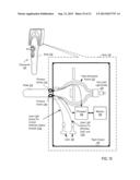 Otoscanner with Camera For Video And Scanning diagram and image