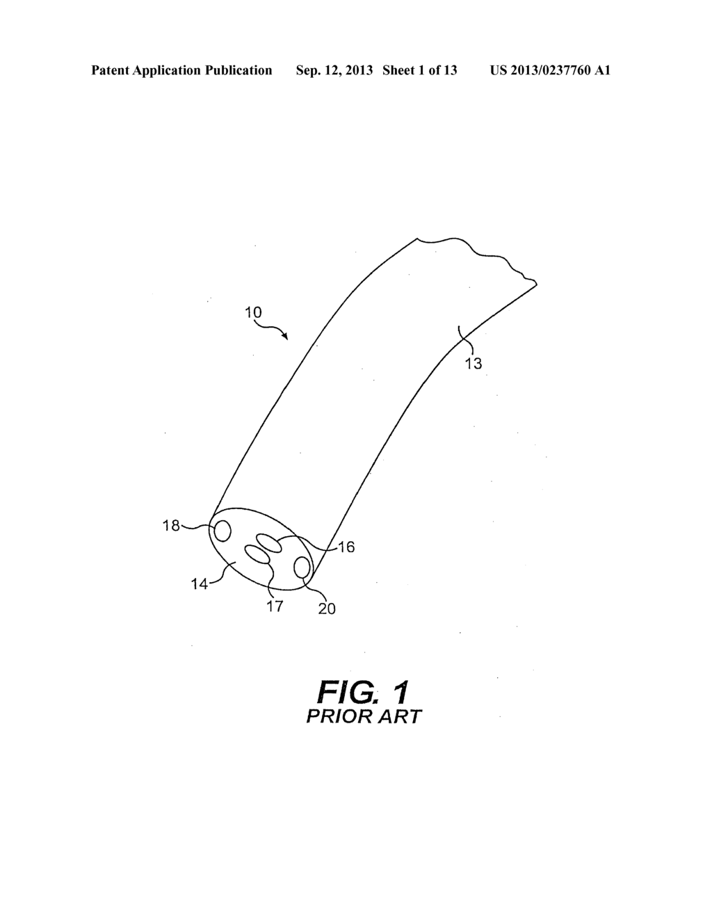 CONTROLLABLE ENDOSCOPIC SHEATH APPARATUS AND RELATED METHOD OF USE - diagram, schematic, and image 02