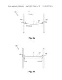 INTERNAL RETRACTOR diagram and image