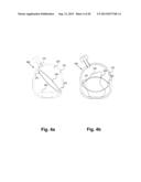 INTERNAL RETRACTOR diagram and image