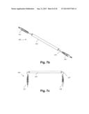 INTERNAL RETRACTOR diagram and image