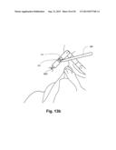 INTERNAL RETRACTOR diagram and image