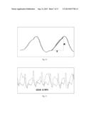 METHOD OF PROCESSING THORACIC REFLECTED RADIO INTERROGATION SIGNALS diagram and image