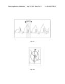 METHOD OF PROCESSING THORACIC REFLECTED RADIO INTERROGATION SIGNALS diagram and image