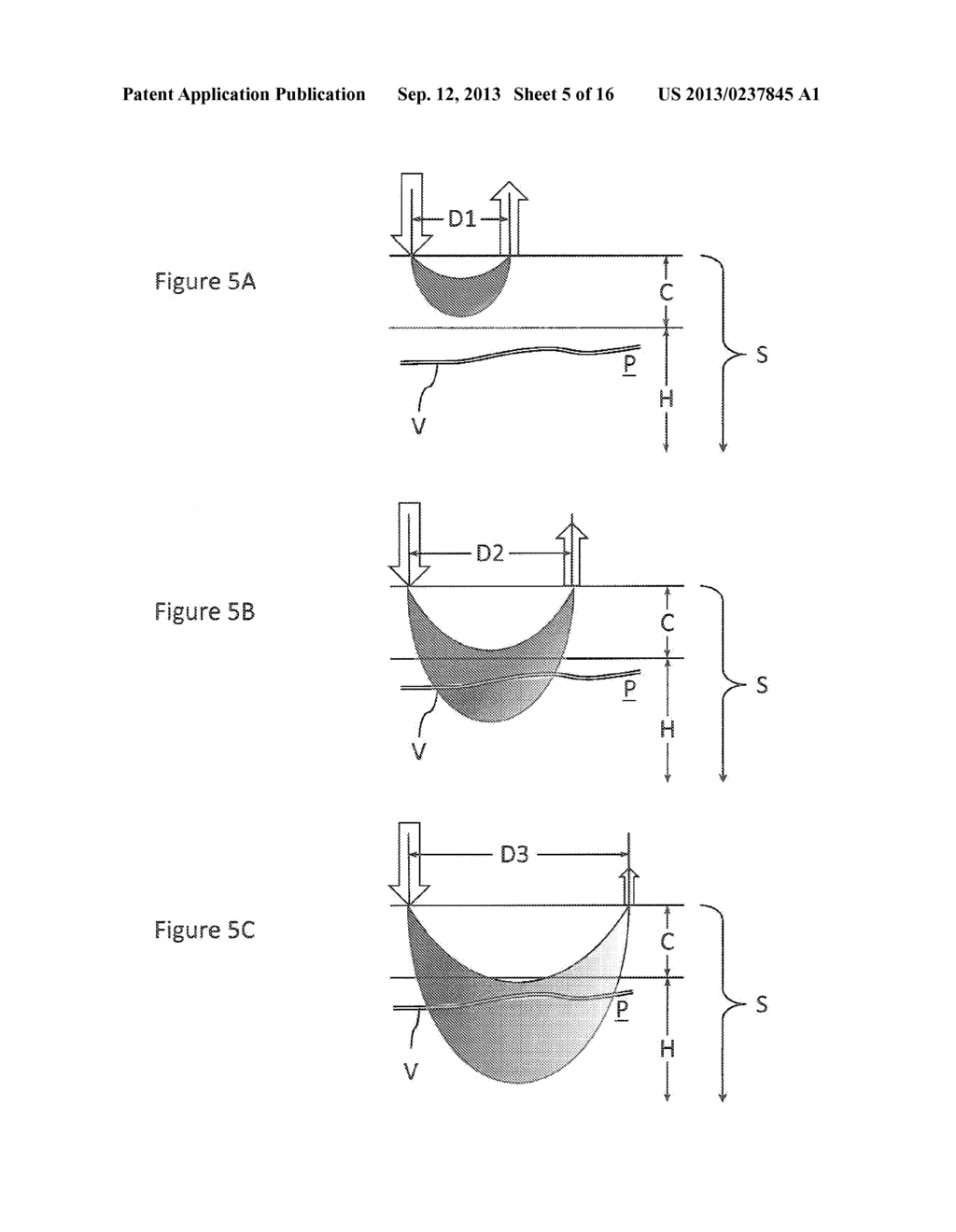 Geometry of a Transcutaneous Sensor - diagram, schematic, and image 06