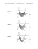 Geometry of a Transcutaneous Sensor diagram and image