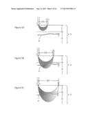 Geometry of a Transcutaneous Sensor diagram and image