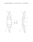 Geometry of a Transcutaneous Sensor diagram and image