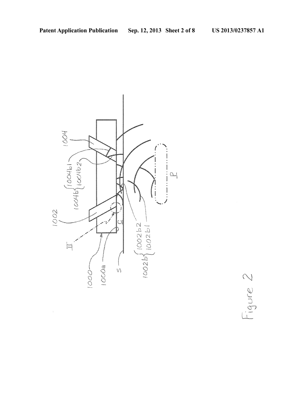 Apparatus and Method for Mitigating Noise Affecting a Transcutaneous     Signal - diagram, schematic, and image 03