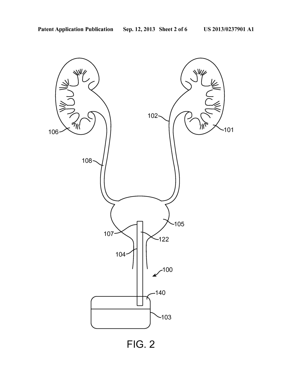 APPARATUS AND METHODS TO TREAT OR PREVENT KIDNEY AND UROLOGIC DISEASE - diagram, schematic, and image 03