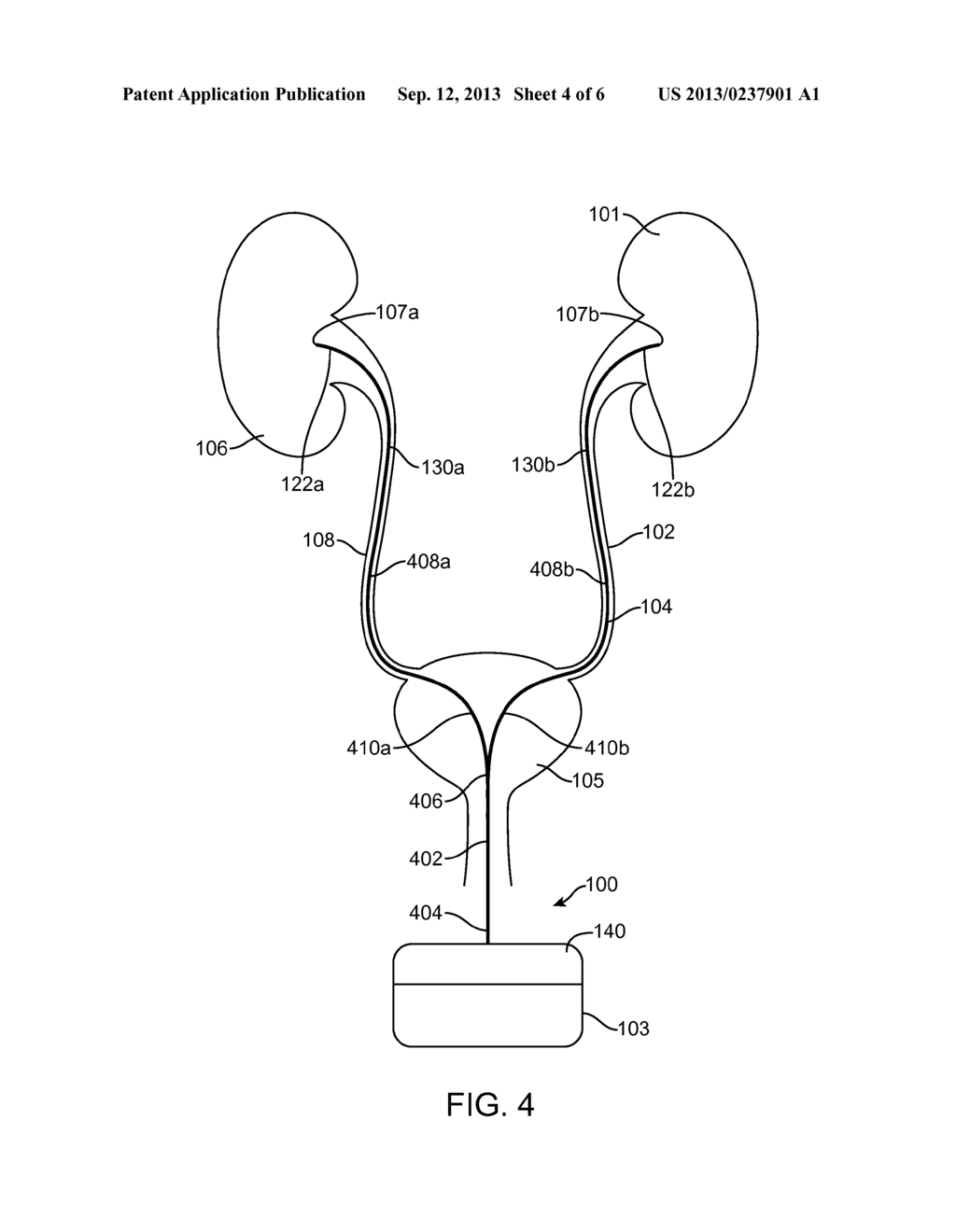 APPARATUS AND METHODS TO TREAT OR PREVENT KIDNEY AND UROLOGIC DISEASE - diagram, schematic, and image 05